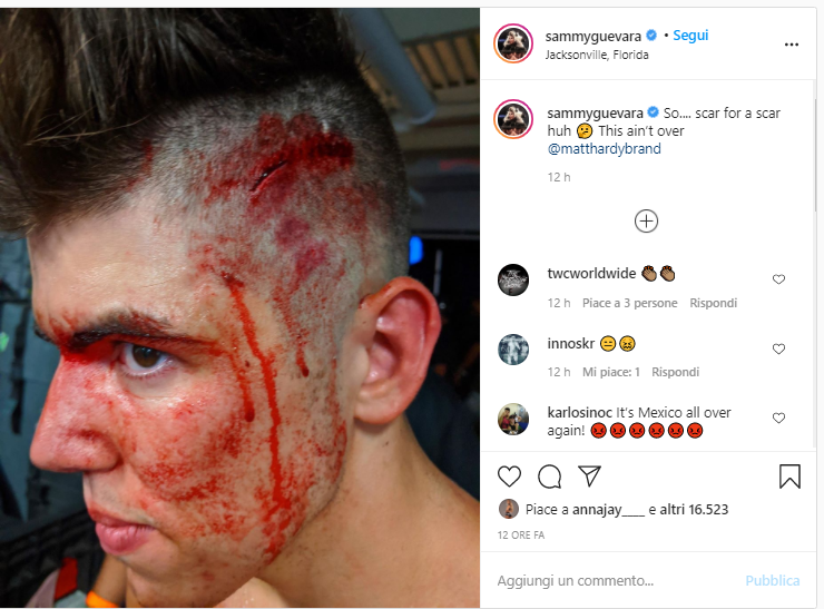 Sammy Guevara mostra la ferita dopo il match con Matt Hardy a Dynamite